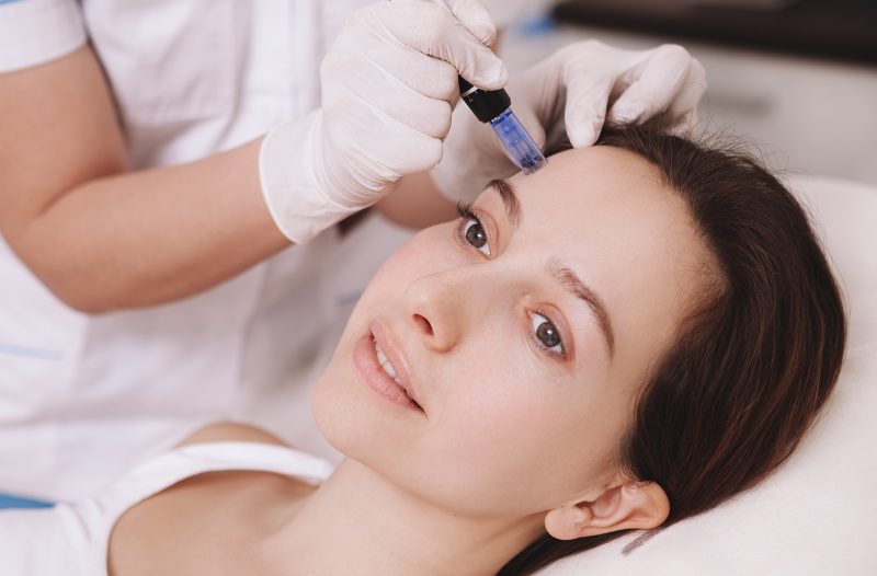 Zagreb - mojzagreb.info - MICRONEEDLING – ŠTO JE I KAKO DJELUJE?